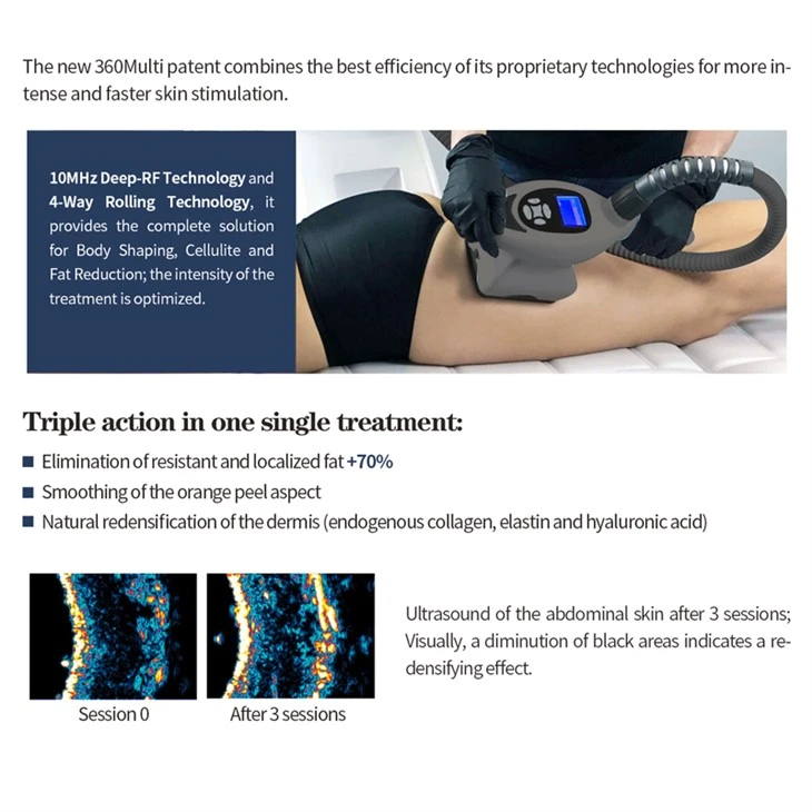 New Vacuum Cavitation body sculpting Machine